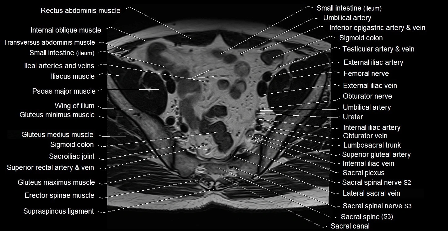 Male pelvis axial cross sectional anatomy image 11.webp